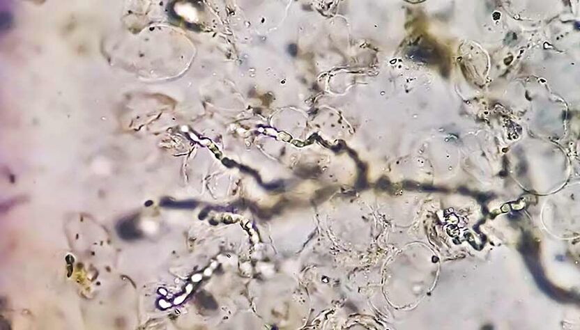 Fungi under the microscope - the culprit in the development of athlete's foot